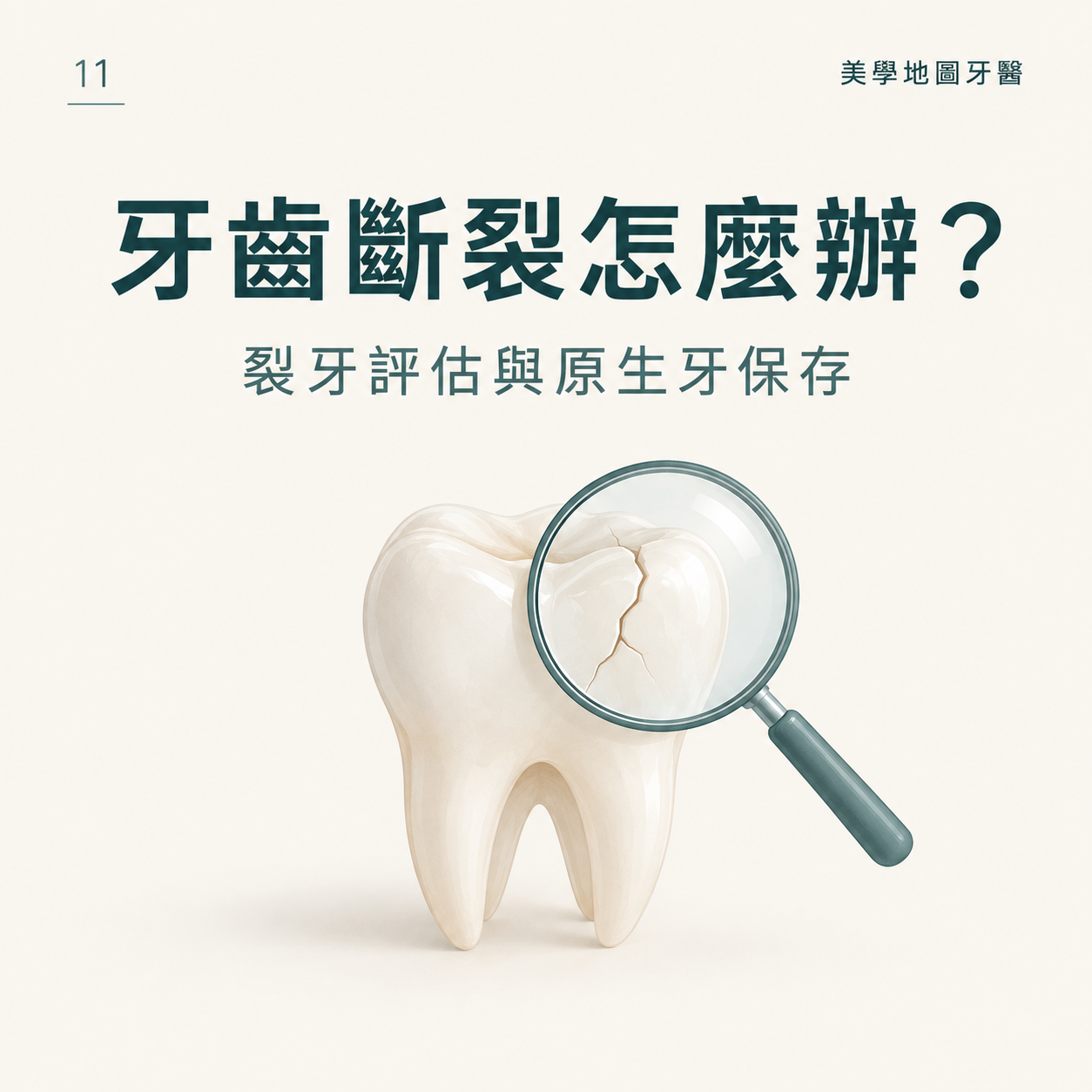 牙齒斷裂怎麼辦？帶你評估裂牙是否要拔與原生牙保存的關鍵