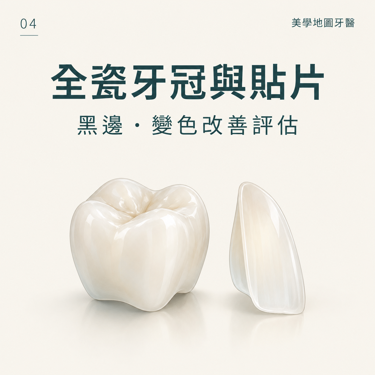 假牙黑邊、牙齒變色怎麼改善?全瓷牙冠與全瓷貼片評估重點 假牙黑邊、牙齒變色怎麼改善?全瓷牙冠與全瓷貼片評估重點