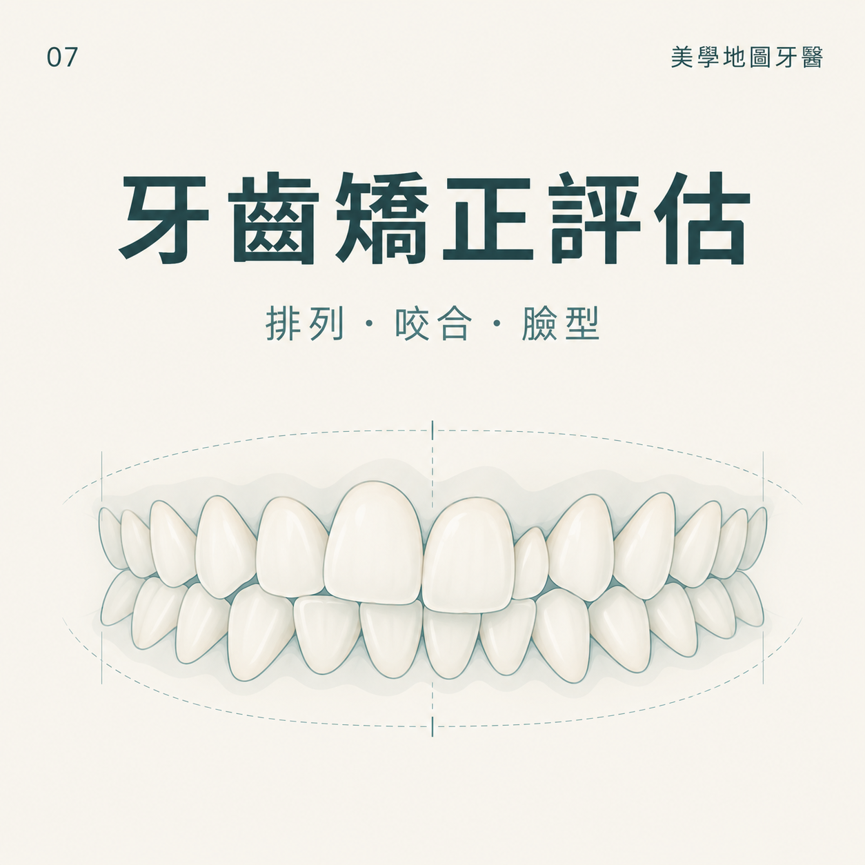 暴牙、齒列凌亂怎麼辦？先確認牙齒排列、咬合與臉型再決定矯正方式