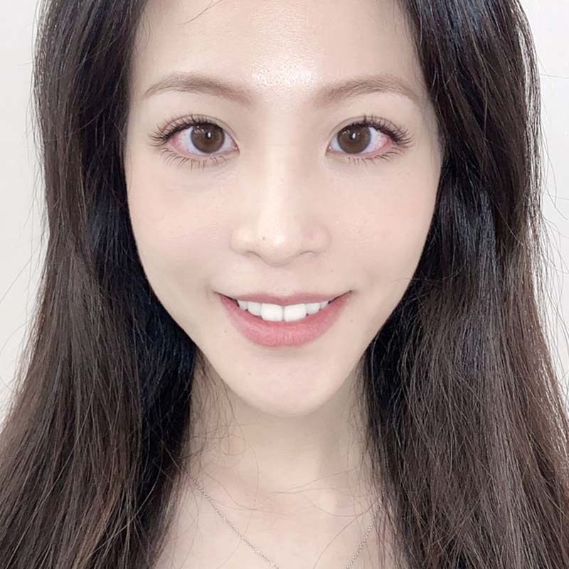 晶鑽牙齒美白 晶鑽牙齒美白